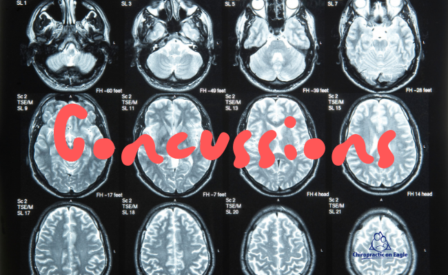 Concussions 2