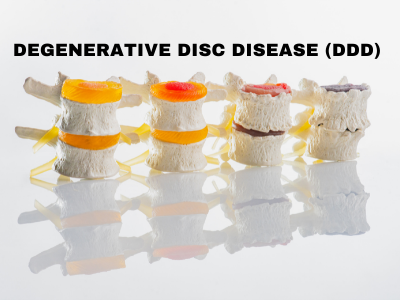 blog ddd 400 × 300 px